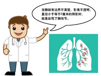 肺结节需要注意什么?